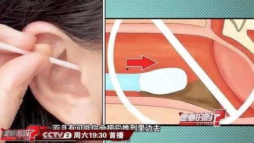 成人需要掏耳朵嘛视频,成人掏耳朵的必要性及正确方法解析